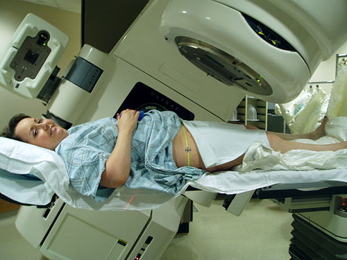 Radiation Therapy
